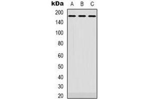 Western blot analysis of EGFR expression in Hela (A), SKOV3 (B), A431 (C) whole cell lysates. (EGFR Antikörper  (C-Term))