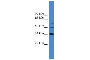 WB Suggested Anti-TRIB1 Antibody Titration: 0. (TRIB1 Antikörper  (C-Term))