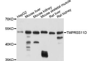 Western blot analysis of extracts of various cell lines, using TMPRSS11D antibody (ABIN4905444) at 1:1000 dilution.