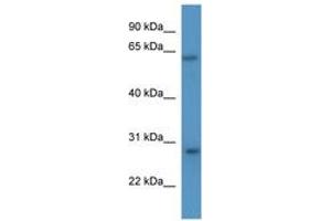 Image no. 1 for anti-Cytokine Inducible SH2-Containing Protein (CISH) (AA 78-127) antibody (ABIN6746363) (CISH Antikörper  (AA 78-127))