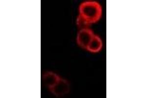 Immunofluorescent analysis of GABARAP staining in MCF7 cells. (GABARAP Antikörper)