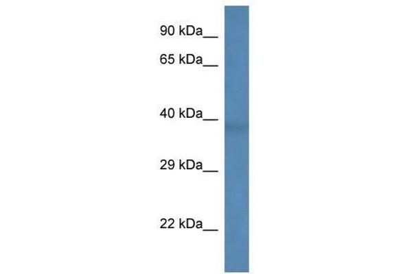 B3GALNT1 Antikörper  (C-Term)