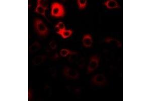 Immunofluorescent analysis of RANBP5 staining in Hela cells. (Importin 5 Antikörper)
