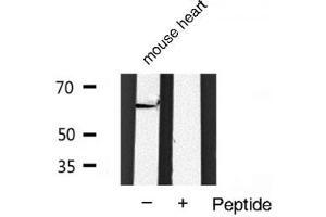 Western blot analysis of PDK1 expression in mouse heart tissue lysates,The lane on the right is treated with the antigen-specific peptide. (PDPK1 Antikörper  (Internal Region))