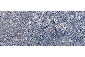 Immunohistochemistry of paraffin-embedded Human tonsil tissue using UBR4 Polyclonal Antibody at dilution of 1:55(x200) (UBR4 Antikörper)