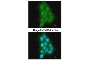 ICC/IF Image Immunofluorescence analysis of paraformaldehyde-fixed A431, using MAGEA11, antibody at 1:500 dilution. (MAGEA11 Antikörper  (N-Term))