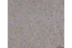 IHC analysis of ADAM22 using anti-ADAM22 antibody (ABIN7600714). (ADAM22 Antikörper  (AA 223-829))