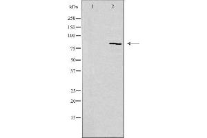 Western blot analysis of extracts from Jurkat cells, using CDH11 antibody. (OB Cadherin Antikörper  (Internal Region))