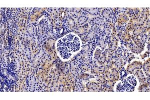 Immunohistochemistry (IHC) image for anti-Prolactin Receptor (PRLR) (AA 25-234) antibody (ABIN7443311)
