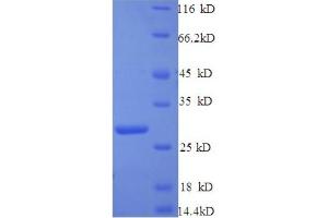 SDS-PAGE (SDS) image for Complement Component 1, Q Subcomponent-Like 1 (C1qL1) (AA 17-258) protein (His tag) (ABIN5713296) (C1ql1 Protein (AA 17-258) (His tag))