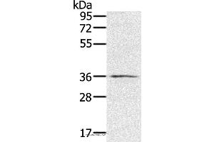 Western blot analysis of TM4 cell, using RNF144B Polyclonal Antibody at dilution of 1:400 (RNF144B Antikörper)