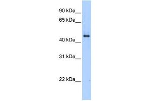 SERPINE1 antibody used at 1 ug/ml to detect target protein. (PAI1 Antikörper  (N-Term))