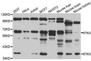 Western blot analysis of extracts of various cell lines, using STK3 antibody. (STK3 Antikörper  (AA 323-450))