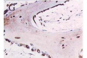 Immunohistochemistry image of Osteonectin staining in par- affn section offetal calvaria. (SPARC Antikörper)