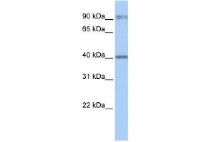 Western Blot showing AIM2 antibody used at a concentration of 1-2 ug/ml to detect its target protein. (AIM2 Antikörper  (N-Term))