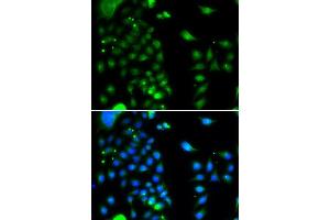 Immunofluorescence analysis of MCF-7 cells using UBE2J2 antibody (ABIN5974418). (UBE2J2 Antikörper)