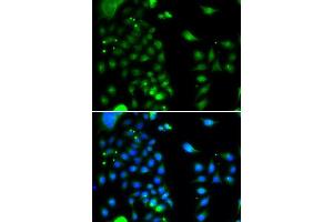 Immunofluorescence analysis of MCF-7 cells using UBE2J2 antibody (ABIN5974418). (UBE2J2 Antikörper)