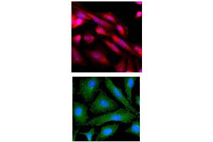 ICC/IF analysis of MAPK3 in HeLa cells line, stained with Hoechst 3342 (Blue) for nucleus staining and monoclonal anti-human MAPK3 antibody (1:500) with goat anti-mouse IgG-Texas Red conjugate (Red). (ERK1 Antikörper  (AA 1-137))