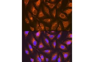 anti-Prostaglandin E Receptor 2 (Subtype EP2), 53kDa (PTGER2) antibody
