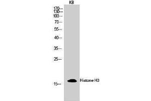 Western Blotting (WB) image for anti-Histone 3 (H3) (Lys428) antibody (ABIN3180089) (Histone 3 Antikörper  (Lys428))