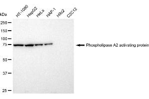 Western blotting analysis using Phospholipase A2 activating protein antibody (ABIN7799820).