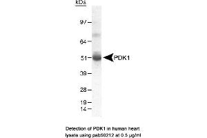 Image no. 1 for anti-Pyruvate Dehydrogenase Kinase (AA 300-400) antibody (ABIN363521) (Pyruvate Dehydrogenase Kinase (AA 300-400) Antikörper)