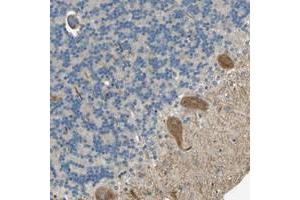 Immunohistochemical staining of human cerebellum with NEXN polyclonal antibody  shows moderate cytoplasmic positivity in purkinje cells. (NEXN Antikörper)