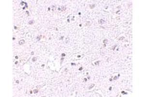 Immunohistochemical staining of human brain tissue with 2. (LASS5 Antikörper  (N-Term))