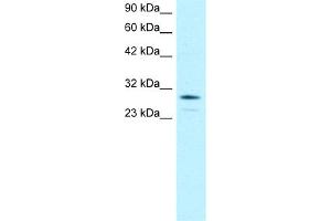 OTX2 Antikörper  (N-Term)