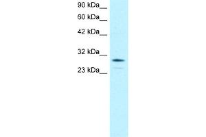 WB Suggested Anti-OTX2 Antibody Titration:  0. (OTX2 Antikörper  (N-Term))