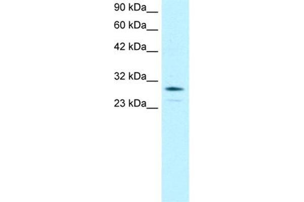 OTX2 Antikörper  (N-Term)
