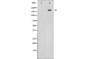 Western blot analysis of HER4 expression in whole cell lysates,The lane on the left is treated with the antigen-specific peptide. (ERBB4 Antikörper  (C-Term))