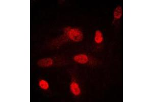 Immunofluorescent analysis of SGK1/2 staining in HeLa cells. (SGK1/2 (Center) Antikörper)