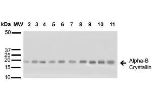 Western blot analysis of Human A431, HCT116, HeLa, HepG2, HEK293, HUVEC, Jurkat, MCF7, PC3 and T98G cell lysates showing detection of ~22 kDa Alpha B Crystallin protein using Rabbit Anti-Alpha B Crystallin Polyclonal Antibody (ABIN361836 and ABIN361837). (CRYAB Antikörper)