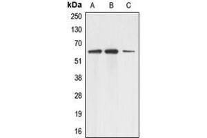 Western blot analysis of Adracalin expression in A431 (A), HEK293T (B), HeLa (C) whole cell lysates. (Adracalin Antikörper  (C-Term))