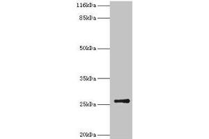 Western blot All lanes: TK1 antibody at 2 μg/mL + CEM whole cell lysate Secondary Goat polyclonal to rabbit IgG at 1/10000 dilution Predicted band size: 26 kDa Observed band size: 26 kDa (TK1 Antikörper  (AA 2-234))