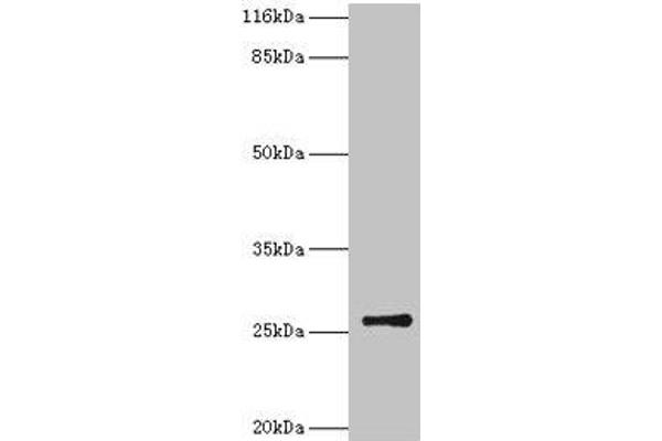TK1 Antikörper  (AA 2-234)