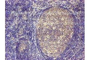 Immunohistochemical staining of paraffin-embedded Human tonsil using anti-MAGEB18 mouse monoclonal antibody. (MAGEB18 Antikörper)