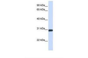 Image no. 1 for anti-BARX Homeobox 2 (BARX2) (N-Term) antibody (ABIN6737832) (BARX Homeobox 2 Antikörper  (N-Term))