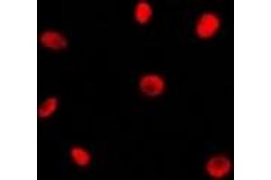 Immunofluorescent analysis of RAD21 staining in Jurkat cells. (RAD21 Antikörper  (C-Term))