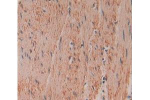 Immunohistochemistry (IHC) image for anti-Gelsolin (GSN) (AA 434-782) antibody (ABIN5013597)