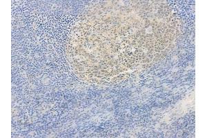 ABIN6264360 and ABIN6278002 at 1/100 staining human normal tonsil tissue by IHC-P. (POU2AF1 Antikörper  (C-Term))