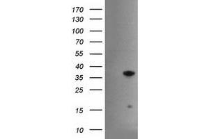 Western Blotting (WB) image for anti-Hes Family bHLH Transcription Factor 1 (HES1) antibody (ABIN1498637) (HES1 Antikörper)