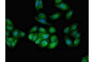 Immunofluorescence (IF) image for anti-Tumor Protein D52-Like 2 (TPD52L2) (AA 1-206) antibody (ABIN7173913)