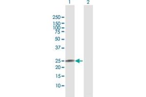 Western Blot analysis of IL22 expression in transfected 293T cell line by IL22 MaxPab polyclonal antibody. (IL-22 Antikörper  (AA 1-179))