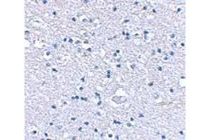 Immunohistochemical staining of human brain tissue using AP30385PU-N Grik4 antibody at 2. (GRIK4 Antikörper  (N-Term))