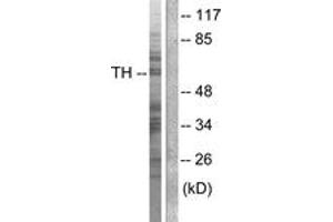 Western blot analysis of extracts from NIH-3T3 cells, treated with Forskolin 40nM 30', using Tyrosine Hydroxylase (Ab-40) Antibody. (Tyrosine Hydroxylase Antikörper  (AA 41-90))