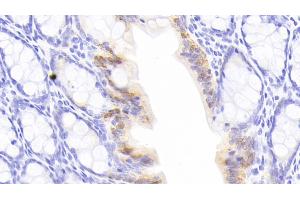 Detection of GAL3 in Rat Colon Tissue using Monoclonal Antibody to Galectin 3 (GAL3) (Galectin 3 Antikörper  (AA 1-262))
