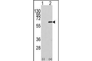 Western blot analysis of AKT1 Antibody (N-term) polyclonal antibody (ABIN391212 and ABIN2841290) (arrow). (AKT1 Antikörper  (N-Term))