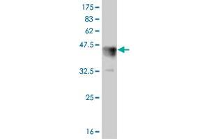 Western Blot detection against Immunogen (37. (LEF1 Antikörper  (AA 33-138))